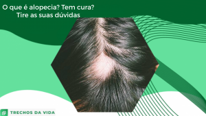 O que é alopecia? Tem cura? Tire as suas dúvidas