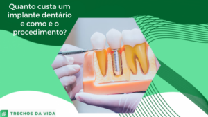 Quanto custa um implante dentário e como é o procedimento?