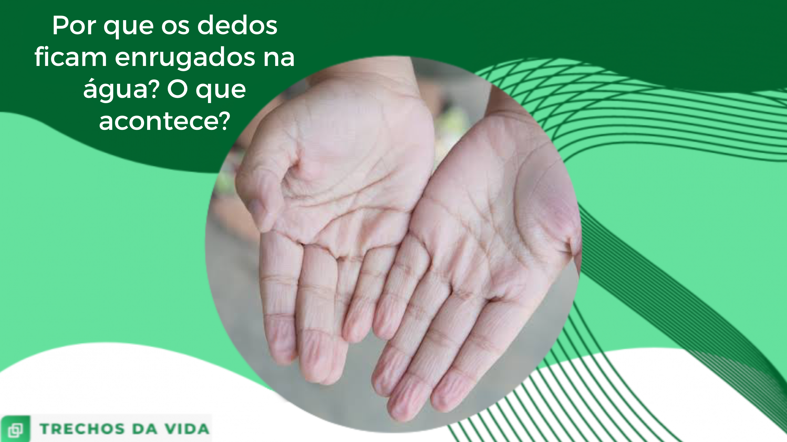 Por que os dedos ficam enrugados na água? O que acontece?