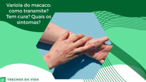 Varíola do macaco: como transmite? Tem cura? Quais os sintomas?