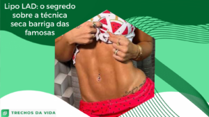 Lipo LAD: o segredo sobre a técnica seca barriga das famosas