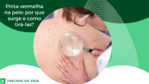 Pinta vermelha na pele: por que surge e como tirá-las?
